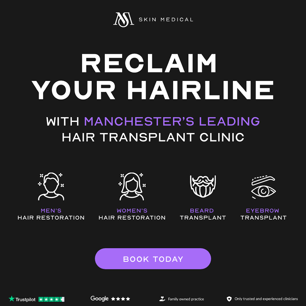 Affordable Hair Transplant Treatment in Manchester