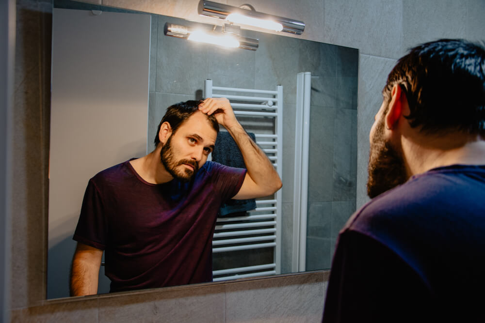 Hair Transplants Recovery Expectations Timeline